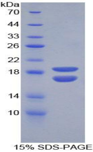 PHPT1 Protein - Recombinant Phosphohistidine Phosphatase 1 By SDS-PAGE