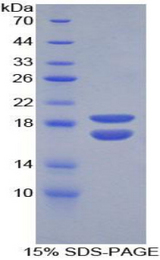 PHPT1 Protein - Recombinant Phosphohistidine Phosphatase 1 By SDS-PAGE