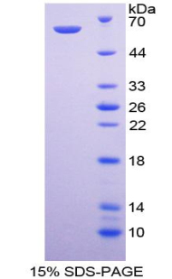 PIK3C2A Protein - Recombinant  Phosphoinositide-3-Kinase Class-2-Alpha Polypeptide By SDS-PAGE