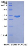 PIKFYVE / PIP5K Protein - Recombinant Phosphoinositide Kinase, FYVE Finger Containing By SDS-PAGE
