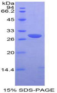 PIM2 / Pim-2 Protein - Recombinant Pim-2 Oncogene By SDS-PAGE