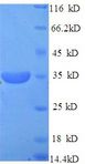 PITX3 Protein