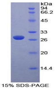 PKLR Protein - Recombinant Pyruvate Kinase, Liver And RBC By SDS-PAGE