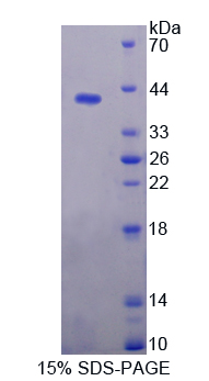 PLA2R / PLA2R1 Protein - Recombinant  Phospholipase A2 Receptor 1 By SDS-PAGE