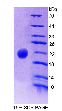 PLCB3 Protein - Recombinant  Phospholipase C Beta 3, Phosphoinositide Specific By SDS-PAGE