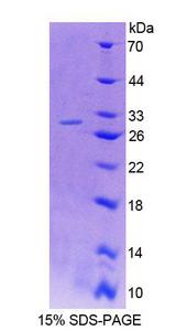PLCD1 Protein - Recombinant Phospholipase C Delta 1 (PLCd1) by SDS-PAGE