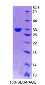 PLCD4 Protein - Recombinant Phospholipase C Delta 4 (PLCd4) by SDS-PAGE