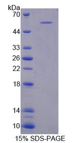 PLEKHA1 Protein - Recombinant Pleckstrin Homology Domain Containing Family A, Member 1 By SDS-PAGE