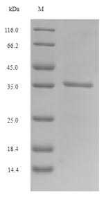 PLET1 / C11orf34 Protein - (Tris-Glycine gel) Discontinuous SDS-PAGE (reduced) with 5% enrichment gel and 15% separation gel.