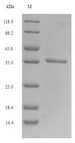 PLET1 / C11orf34 Protein - (Tris-Glycine gel) Discontinuous SDS-PAGE (reduced) with 5% enrichment gel and 15% separation gel.
