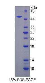 PLIN1 / Perilipin Protein - Recombinant Perilipin 1 (PLIN1) by SDS-PAGE