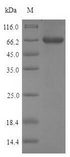 PNLIP / PL / Pancreatic Lipase Protein - (Tris-Glycine gel) Discontinuous SDS-PAGE (reduced) with 5% enrichment gel and 15% separation gel.