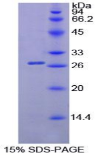 PNLIP / PL / Pancreatic Lipase Protein - Recombinant Lipase, Pancreatic By SDS-PAGE