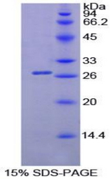 PNLIP / PL / Pancreatic Lipase Protein - Recombinant Lipase, Pancreatic By SDS-PAGE