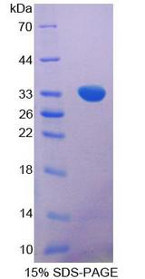 POMC / Proopiomelanocortin Protein - Recombinant Proopiomelanocortin By SDS-PAGE