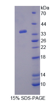 PON2 Protein - Recombinant Paraoxonase 2 By SDS-PAGE