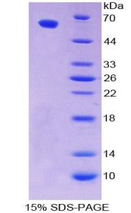 POU2F1 / OCT1 Protein - Recombinant Octamer Binding Transcription Factor 1 By SDS-PAGE