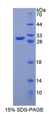 POU5F1 / OCT4 Protein - Recombinant  Octamer Binding Transcription Factor 4 By SDS-PAGE
