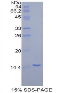 PPARD / PPAR Delta Protein