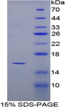 PPARG / PPAR Gamma Protein - Recombinant Peroxisome Proliferator Activated Receptor Gamma By SDS-PAGE