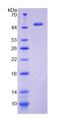 PPHLN1 Protein - Recombinant  Periphilin 1 By SDS-PAGE