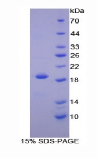 PPIA / Cyclophilin A Protein - Recombinant Cyclophilin A By SDS-PAGE