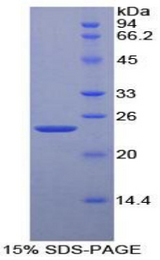 PPID / Cyclophilin D Protein - Recombinant Cyclophilin D By SDS-PAGE
