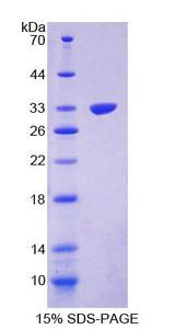 PPP1R15A / GADD34 Protein - Recombinant Protein Phosphatase 1, Regulatory Subunit 15A By SDS-PAGE