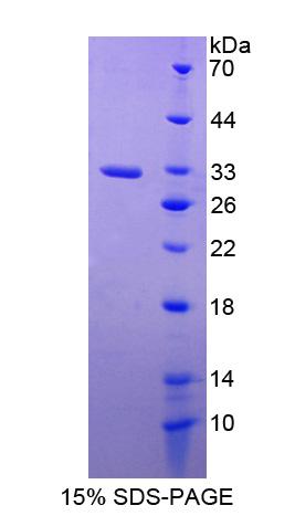 PPT1 / CLN1 Protein - Recombinant Palmitoyl Protein Thioesterase 1 By SDS-PAGE