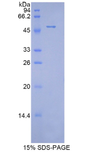 PRDX1 / Peroxiredoxin 1 Protein - Recombinant Peroxiredoxin 1 By SDS-PAGE