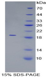 PRDX5 / Peroxiredoxin 5 Protein - Recombinant Peroxiredoxin 5 By SDS-PAGE