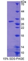 PRDX6 / Peroxiredoxin 6 Protein - Recombinant Peroxiredoxin 6 (PRDX6) by SDS-PAGE