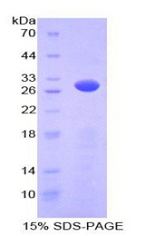 PRKAG2 / AMPK Gamma 2 Protein - Recombinant Protein Kinase, AMP Activated Gamma 2 By SDS-PAGE