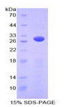PRKAG2 / AMPK Gamma 2 Protein - Recombinant Protein Kinase, AMP Activated Gamma 2 By SDS-PAGE