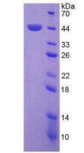 PRKCD / PKC-Delta Protein - Recombinant Protein Kinase C Delta By SDS-PAGE