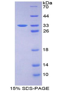 PRKD1 / PKC Mu Protein - Recombinant Protein Kinase D1 By SDS-PAGE
