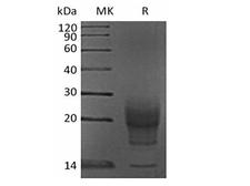PRL / Prolactin Protein - Recombinant Mouse Interleukin-5/IL-5 (C-6His)