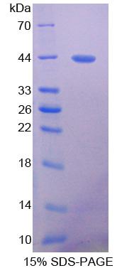 PRLTS / PDGFRL Protein - Recombinant Platelet Derived Growth Factor Receptor Like Protein By SDS-PAGE