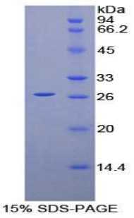PRNP / PrP / Prion Protein - Recombinant Prion Protein By SDS-PAGE