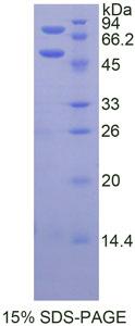 PROC / Protein C Protein - Recombinant Protein C By SDS-PAGE