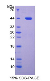 Procalcitonin Protein - Recombinant Procalcitonin (PCT) by SDS-PAGE