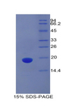 PROCR / EPCR Protein - Recombinant Protein C Receptor, Endothelial By SDS-PAGE