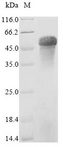 Properdin / CFP Protein - (Tris-Glycine gel) Discontinuous SDS-PAGE (reduced) with 5% enrichment gel and 15% separation gel.