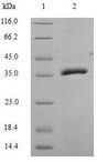 Properdin / CFP Protein - (Tris-Glycine gel) Discontinuous SDS-PAGE (reduced) with 5% enrichment gel and 15% separation gel.