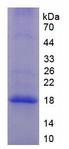 Properdin / CFP Protein - Recombinant Complement Factor P By SDS-PAGE