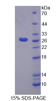 Prostaglandin D Synthase Protein - Recombinant Prostaglandin D2 Synthase, Hematopoietic By SDS-PAGE