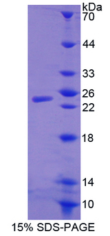 PS20 / WFDC1 Protein - Recombinant  WAP Four Disulfide Core Domain Protein 1 By SDS-PAGE