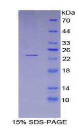 PSIP1 / LEDGF Protein - Recombinant Lens Epithelium Derived Growth Factor By SDS-PAGE
