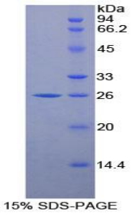 PSMB8 / LMP7 Protein - Recombinant Large Multifunctional Peptidase 7 By SDS-PAGE