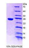 PSMB9 Protein - Recombinant Large Multifunctional Peptidase 2 By SDS-PAGE